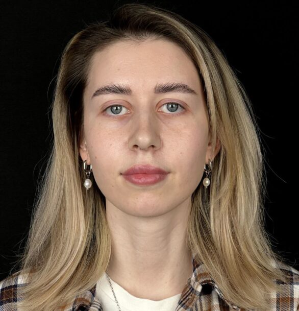 Риносептопластика в Москве