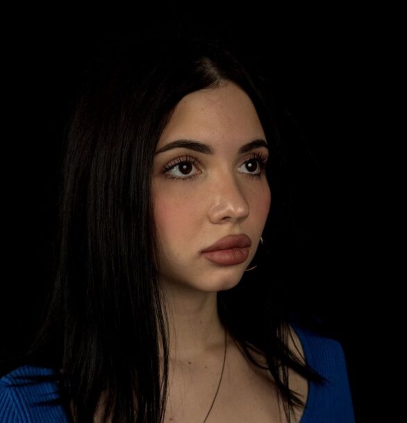 Хирургическое лечение птоза века в Москве