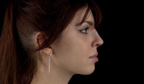 Костная ринопластика в Москве