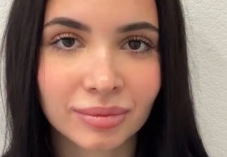 Лифтинг-блефаропластика в Москве